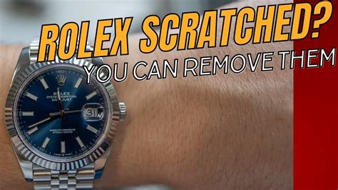 rolex datejust scratches|Removing Scratches from a Rolex Watc.